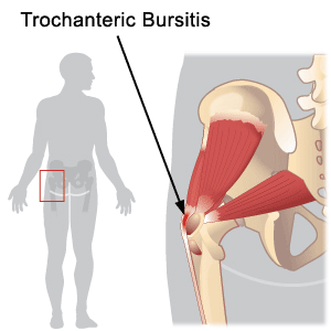 Orthopedic Doctor Los Angeles