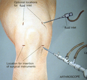 Knee Doctors in Los Angeles